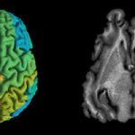 Israeli Researchers Develop MRI Technique To Detect Molecular Changes In Brain