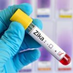 Israelis Identify Genes That Protect Cells From Zika Virus